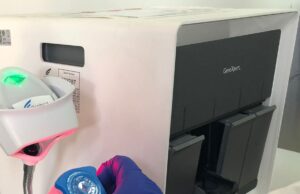 Un prelievo al dito svela in anticipo la presenza dell’epatite C
