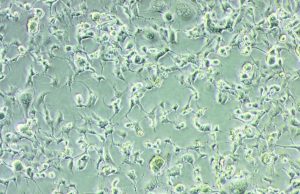 Isolata in Puglia la variante Omicron dall’Istituto Zooprofilattico Sperimentale: “adesso potremo avere informazioni fondamentali per contenere il virus”