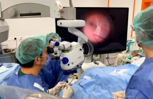 Virus immesso sotto la retina per trasferire il gene e recuperare la vista: straordinario intervento oculistico al Policlinico di Bari