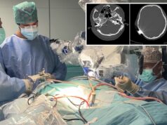 Ragazza recupera l’udito grazie a innovativo impianto al tronco encefalico realizzato al Policlinico di Bari
