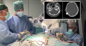 Ragazza recupera l’udito grazie a innovativo impianto al tronco encefalico realizzato al Policlinico di Bari