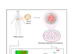 Tumore del pancreas: sensori “intelligenti” nei tessuti misurano la risposta alla chemioterapia