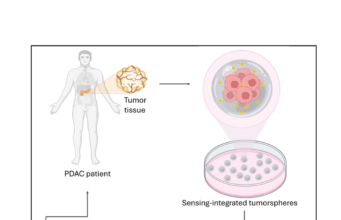 Tumore del pancreas: sensori “intelligenti” nei tessuti misurano la risposta alla chemioterapia
