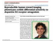 Schizofrenia, studio UniBa: dalla risonanza magnetica nuovi indizi per personalizzare le terapie farmacologiche